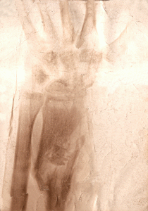 final-xrays-x2-1916